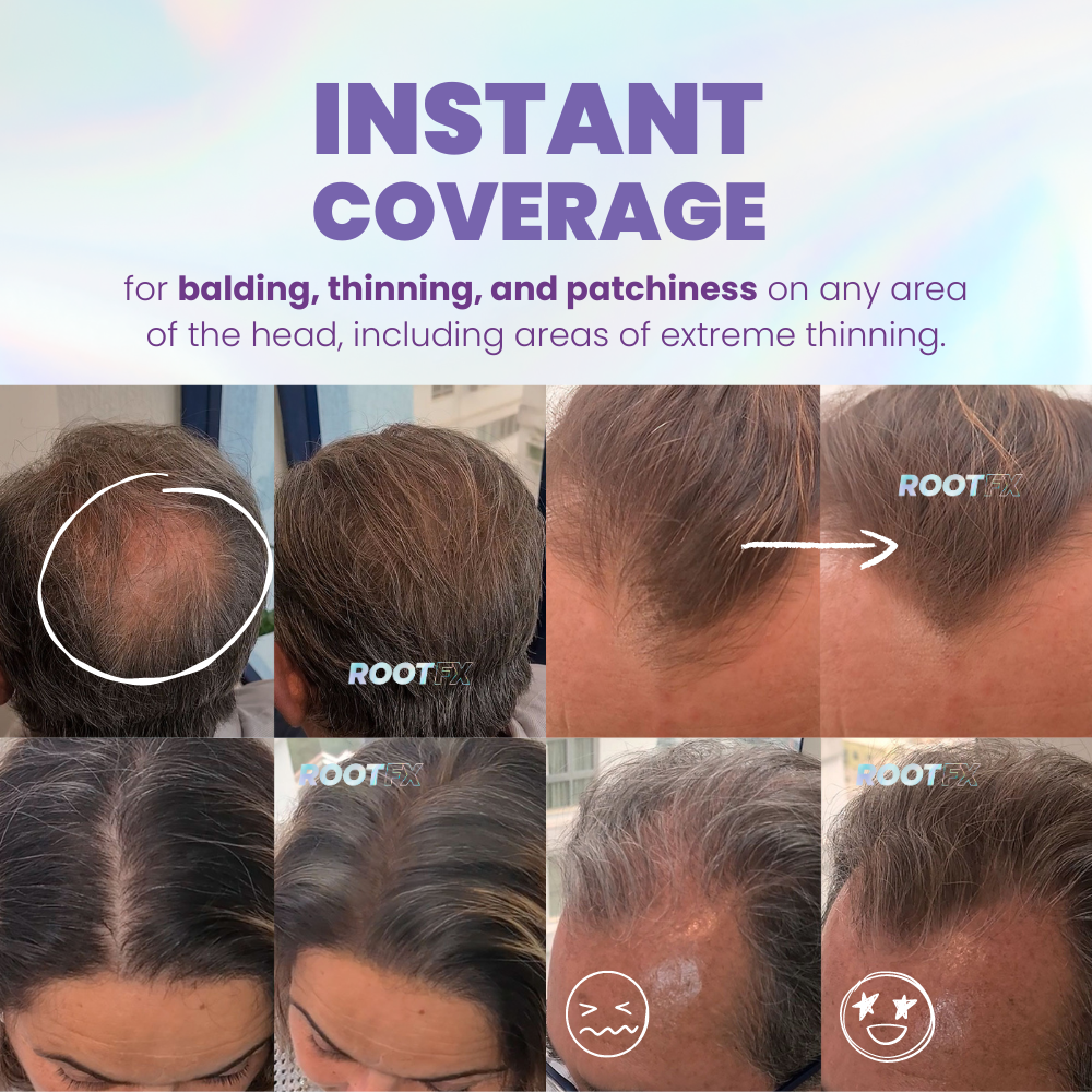RootFX Natural Hairline Powder